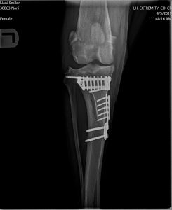 Post Op x-ray of TTA cruciate rupture in dogs
